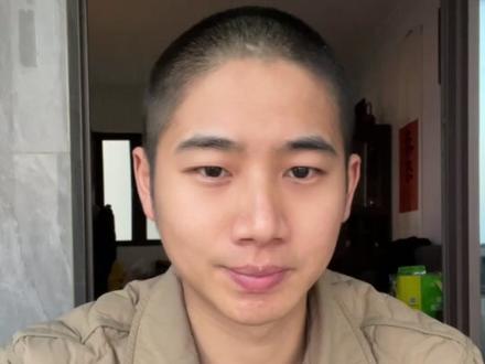 剃光头,重新再养一遍 #脱发 #掉发 #养发 #护发 #米诺地尔