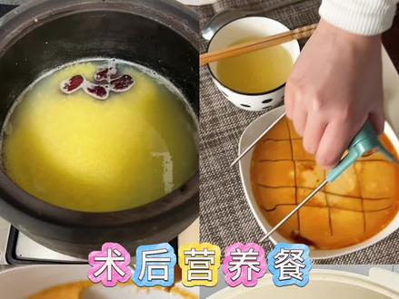 肠胃息肉术后营养餐 #蒸鸡蛋羹 #肠胃息肉 #肠胃镜检查