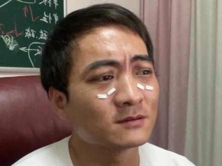 被自家狗猫咬伤抓伤需要去打狂犬疫苗吗?#猫咪 #狂犬疫苗 #狗狗 #兽医