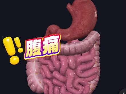 腹痛,警惕3种急腹症 #医学科普 #腹痛
