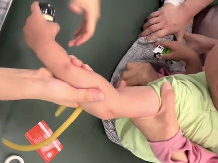 昨天评论里都要小孩哭声,我多宠粉呀,安排#留置针单手退针 #医患关系如此和谐 #儿童输液 ##致敬医护人员