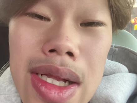 严迪我心疼你#惊蛰无声