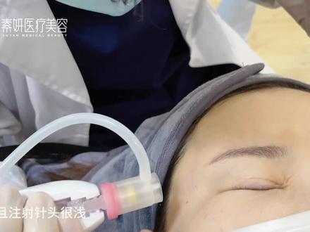 #御龄双子针 #改善静态细纹
变美我是行动派,说做就做。
双子针标准搭配来操作
元气针2.5ml➕烫纹针1.5ml抗皱胶原
不够完美,那就努力变得完美