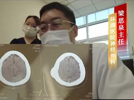 骨瘤绝大多数为良性,生长缓慢。影响日常生活可以手术切除#骨瘤 #环湖医院 #神经外科 #医学科普