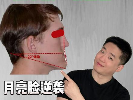 月亮脸逆袭:每天5分钟,把下颌“收回去” #月亮脸#地包天 #下巴前伸 #地包天矫正