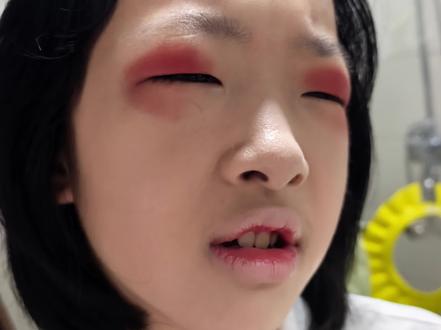 给女儿化的六一儿童节舞台妆:两条又浓又粗一高一低的毛毛虫,红色的熊猫眼圈,配一张香肠嘴。她说我这样像被打了一样,你画成这样,我这一天在学校都抬不起头了。额,确实有亿点点好笑呢,哈哈哈。那效果图咱也不敢拍照了怕被她揍。后面只能战战兢兢小心翼翼重新化一下,也算交差了。我的孩子们摊上这么一个妈,也是没辙了,哈哈哈