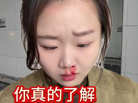 #预防艾滋病手抄报 #hiv病毒 #人性 #艾滋病