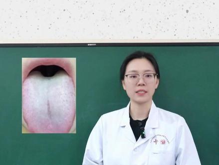 白厚苔,吃平胃散、二陈芄无效者,不妨试试先藿香正气,再苓桂术 #热点 #中医