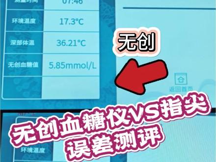 1测血糖不用扎针!终于来了 #无创血糖仪 #测血糖不用扎针 #血糖仪 #糖友必备 #健康好物新招数