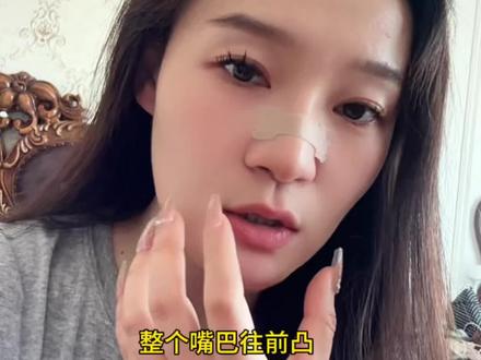 明星自用通气鼻贴 不踩坑!#张艺兴 #范辰辰#止鼾#鼻贴#通气