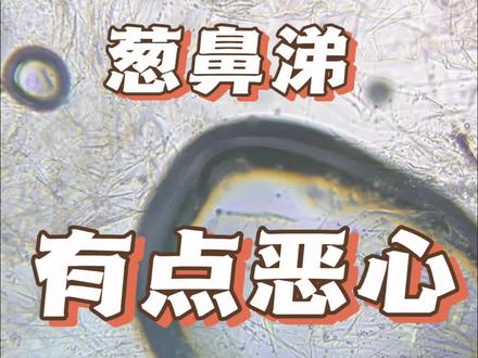 葱鼻涕看着有点那啥啊!#涨知识 #葱 #科普一下 #植物