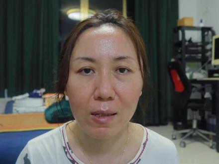 #抗衰老 #点阵 #剥脱点阵co2 #变美 #痘坑 #毛孔粗大 #痘印 点阵2个月毛孔状态