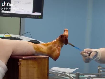 原来碘伏还有这种用处#碘伏