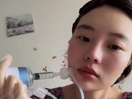 海菲haifeel水光机测评
#护肤 #自用好物分享 我应该是目前视频分享🀄️最详细的一位
首先洗脸 敷麻 我用的是麻舒痛 (本人敏感肌)敷的厚一点,用保鲜膜包裹上,敷40分钟吧 时间久一点麻的效果会更好,敷麻期间就可以准备器材 ,浸泡过生理盐水的纱布➕碘伏纱布,产品用二通管先兑好装入海菲haifeel水光机,我打的是9🪡的4mm,🪡头位置可以调节长短,可以针对脸部不同位置的需求,管筒用的5ml,发数调到0.5/100发,擦拭掉麻膏,先后用碘伏生理盐水过3遍消毒,接下去就可以开打了,注意⚠️的是仪器要垂直进去皮肤,按一下健自动进💊,傻瓜式操作很简单,新手也比较容易上手,漏💊情况不明显 ,在🉑️接受范围内,全脸打完之后,最后用滚针过一遍脸..接着敷片“面膜中的战斗机”敷尔佳面膜完美结束🔚
总结:性价比还是挺高的 自己做一次算起来才几百块 产品用的还纯,操作简单 (麻膏用不完要放冰箱保存,面膜放#护肤分享 #