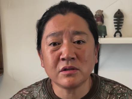 孩子发育迟缓怎么办 #幼儿教育 #发育迟缓