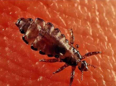 人体第三种虱子:体虱 无论是头虱、体虱还是阴虱,它们都无法离开自己活动的区域,否则就会很快就#虱虫科普 #虱子 #体虱