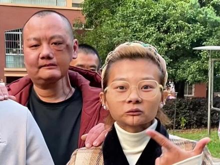 初嚼不知槟榔危,后悔已是割脸人,他们就是因为当初不听家人朋友劝,长期咀嚼槟榔,导致割脸,希望通过他们的教训,能够唤醒更多人及时戒掉槟榔,远离槟榔,珍惜口腔,转发传递正能量!