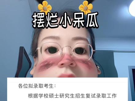 仅供参考。研究生调档、录取通知书地址确认、党组织关系转移、户口迁移这些事情每一项都和我们能否顺利入学息息相关,大家一定要认真对待,严格按照学校要求的时间节点和流程去完成。要是在办理过程中有任何疑问,随时咨询学校研招办或者已经上岸的学长学姐,他们肯定能给你提供有用的建议。最后,祝大家都能顺顺利利开启研究生生活,在学术道路上一路开挂! #研0 #研究生上岸 #考研调档 #研究生