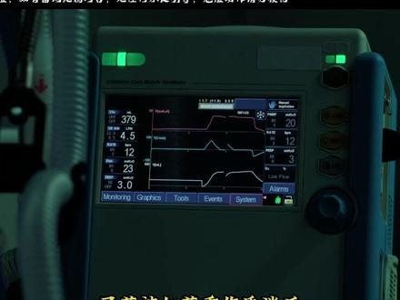 猎犬第四集上 在暴力叙事中深埋人性,探讨守护家人、朋友及拳击尊
严的救赎之路 。#真实生活 #分享计划 @抖音小助手