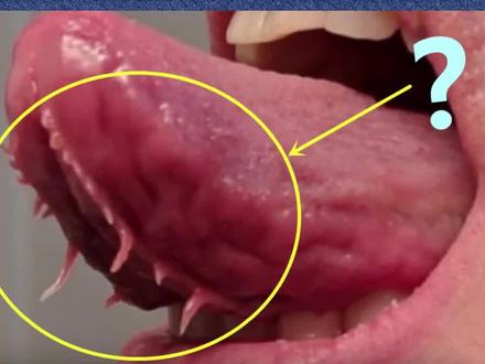 舌头上的这些秘密,你发现了吗?你有吗?你对舌头又有哪些误解呢? #涨知识