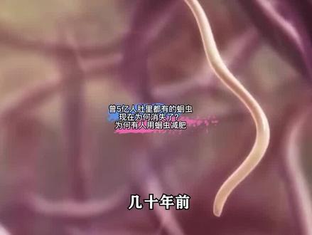 曾5亿人肚里都有的蛔虫,现在为何消失了?为何有人用蛔虫减肥