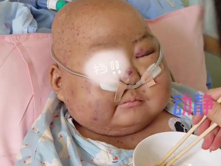 #贵州10岁白血病男孩豪豪病情牵动人心 家人发文感谢家乡的叔叔阿姨们。