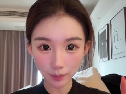 植发完的流程一般是这样#冷知识科普 #一般人不告诉他