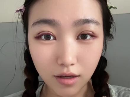姐妹们双眼皮真的好看,冲冲冲#双眼皮恢复记录 #双眼皮蜕变