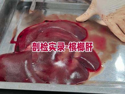 槟榔肝 一般见于霉菌毒素中毒或者西药过度使用引起的脂肪变性。通过肝脏病变判断可能发生的疾病#猪病防控 #所有养猪人 #养猪人加油干 #养猪人不容易 #养猪技术