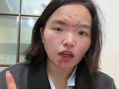 可能我也冲动了至于你们疑惑为什么是这样的关系 后续我会发时间线 就这样了 彻底解脱了#上热搜 #上热门 #痘痘肌 #无美颜无滤镜最真实的模样