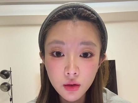鼻子到底是玻还是再生? #鼻子 #do鼻 #变美