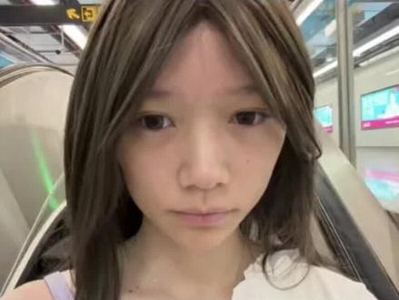 一期缩鼻翼三个月的Q&A#缩鼻翼