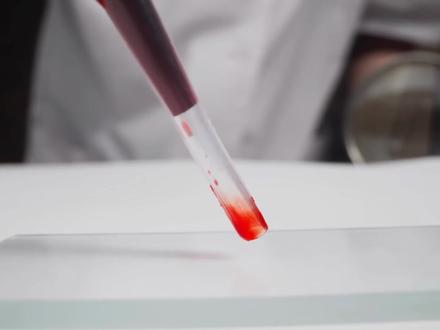 鲎:蓝血生物。 你打的每一针疫苗,都有这种蓝血生物的功劳。它就是鲎,也叫马蹄蟹,拥有蓝色的血液,每年50万只被人类抓上岸,插上针管抽它们30%的血,然后扔回海里自生自灭。没有它的蓝血,全球医疗系统会直接崩盘,因为它能检测出人类仪器根本看不见的致命细菌。它活了4.8亿年,熬死了恐龙、冰河时代,如今却可能死在人类手里。这个连大脑都没有,却救了几十亿人命的生物,凭什么能成了医学界的神?#鲎 #科普 #知识前沿派对 #核爆 #省流科普