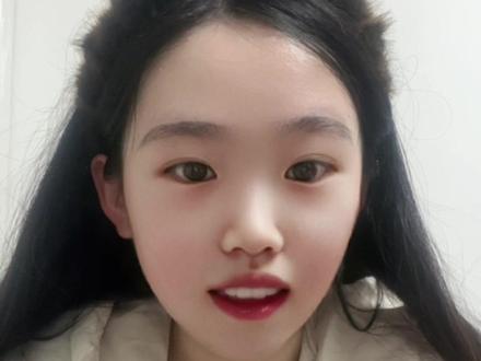 大家肯定都知道抑郁症吧,但是大家知道生理性抑郁吗?我先说一下啊,所有的情绪跟大脑分泌的激素都是相关的,你开心的时候可能是开心的激素很高,不开心的时候那就是开心激素浓度低,
就像你遇到紧急危险的当下,你的肾上腺素会迅速飙升,就为了能在瞬间支配你的肢体去躲避危险,但是等你成功避开危险后,对应的你的肾上腺素浓度也会慢慢降下来,如果你体内无法自动把肾上腺素浓度降下来,那你在处于不危险的时候,你就还是会各种紧绷,长时间处于应激状态,那你的身心平衡就被打破了,你就处于异常了。
所以任何人都会有不开心的时候,这时候你不开心的激素浓度就比较高,但是正常来说,这种不开心只会持续一个比较短暂的时间,要么你会转移注意力,就被开心的事情吸引,你的开心激素上升,要么慢慢你会适应这个不开心的事情,情绪会慢慢趋于变得平静,这也是生命对身体的保护,所以你认为那些你完全接受不了的失恋也好、被背叛的痛苦也好等等,其实都会在一段时间后慢慢适应,高度的痛苦感持续时间比你想象的要短,我懒得查文献了,大家有兴趣可以去查一下这个具体的时间,肯定不会超过半年,不然人类就要完犊子了。
所以,经常很多人说自己遇到了一个特别大的打击,产生了极大的痛苦,然后我都会问一下,这个事情是发生多久了,如果他告诉我,他昨天遭遇爱人背叛了,那我只能告诉他,你没有心理问题,你这是正常情绪。
但是,如果你超级极大痛苦的持续时间超过正常的范畴,你一年前被背叛,你现在偶尔想起来还是痛苦这是正常的,但是如果你这一年还持续每天以泪洗脸、无法正常社交、天天睡不着,那这肯定就不对了
说明你身体对这个痛苦激素的浓度难以调节,这时候在临床上就会开始关注,你是不是进入抑郁状态了,实际上不用等一年那么久啊,我只是用一个夸张的说法来让大家区分正常悲伤和抑郁状态,一般持续时间超过两周就可以关注自己的身心状态,如果超过一个月还高浓度痛苦,就要小心了
所以呢,讲这么多,就是想说,你的情绪和身体内的激素浓度是一一对应的,正常情况都是具备调节浓度高高低低的能力,该开心的时候你开心,该伤心的时候你伤心,该愤怒的时候你愤怒,这些都是正常的
然后回到生理性抑郁这个话题,可能日常中,大家也会觉得抑郁了就可以自己调节,不需要吃药,觉得吃药抗抑郁的都是弱者,强者可以克服一切心理问题。
#抑郁症 #抑郁症患者 #抑郁症自救 #抑郁症的表现 #抑郁症焦虑症