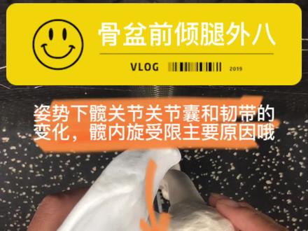 #骨盆前倾 #外八字 #关节囊
抑制髋关节囊后外侧是一件重要的事情#髋关节内旋受限 #运动康复