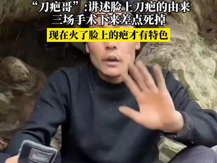 张家界七星山荒野求生决赛,“刀疤哥”:讲述脸上刀疤的由来,三场手术下来差点死掉,现在火了脸上的疤才有特色