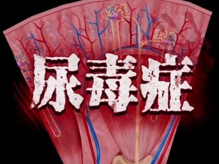 尿毒症为什么会尿量减少 减少背后的原因你知道吗 #尿毒症 #尿量减少 #肾脏健康 #医者仁心