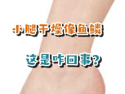 小腿干燥的像是“鱼鳞”,这是咋了?#鱼鳞#肌肤甲错