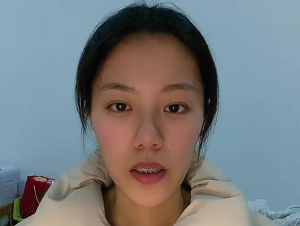 整牙很疼,但有些疼是正常的!#牙齿矫正 #整牙 #拔牙