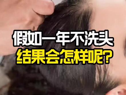 假如一个人一年不洗头,结果会怎样呢?#热门 #涨知识 #科普知识 #萌知计划 #科普 #抖音青少年 #科普一下