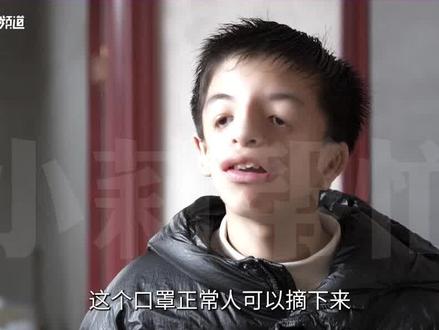 15岁男孩患有鸟面综合症,因经常被嘲笑 怕吓到别人,无奈戴着口罩,躲在屋里默默流泪,在老师和同学们的鼓励下摘下口罩#河南dou知道