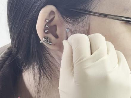 无敌直角埋钉过程全记录美德姨p#耳屏钉 #穿孔