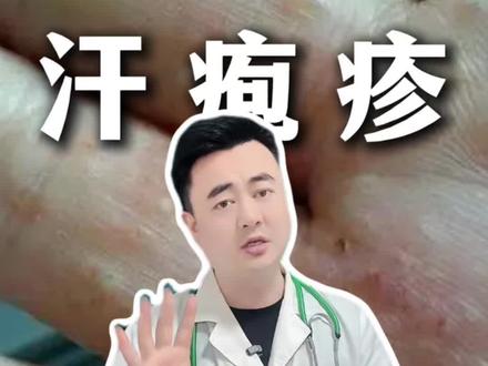 手指手掌长小水泡,怎么办? 手指手掌长小水泡,这是汗疱疹怎么办?#汗疱疹 #科普 #健康