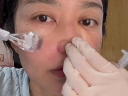 43岁苹果原相机无美颜,无滤镜前置镜头拍摄#记录自己 #滚水光 #变美 #皮肤管理 #居家滚轮水光