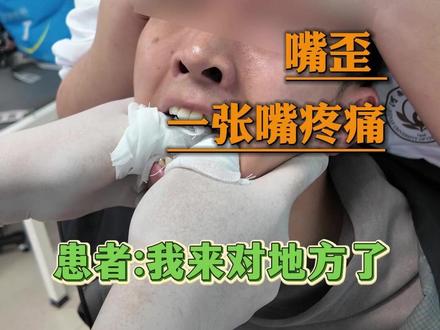 男子颞下颌关节紊乱不可复 嘴歪 一张嘴就疼#颞下颌关节紊乱 #中医正骨 #中医针灸 ##关节疼痛 #中医正骨谢梦迪