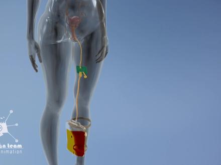 男士勿进,女性拔尿管过程,3D演示。。#视觉艺术 #三维动画 #解剖