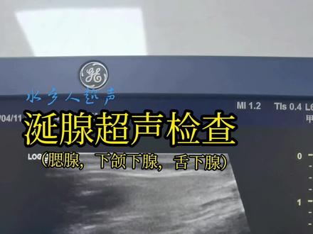 有山就有路,有河就能渡#热门 #医学影像 #超声医学 #涎腺超声检查