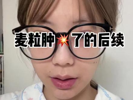 实在没有想到这件事还有后续不过谢谢大家的关心我没事哒#日常vlog