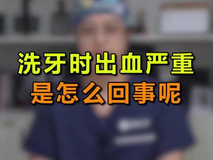 洗牙时出血是怎么回事,看完你就知道了#牙齿矫正 #口腔科普