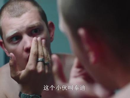 小伙眼球里长出毛发,变异? #宅家dou剧场